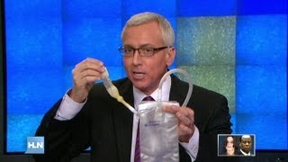 Dr. Drew examines Michael Jacksonâs autopsy report