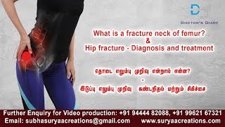 Hip fracture - Diagnosis and treatment