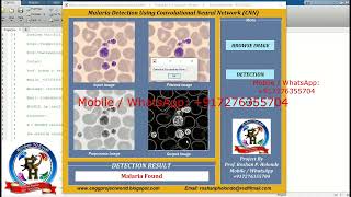 Malaria Detection Using Image Processing | With Source Code | Malaria Identification Using CNN