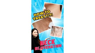 Unlocking the Secrets of Neck Line Rejuvenation with Dr. Shuyan