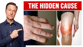 The Hidden Cause of Arthritis in Your Knees and Hands