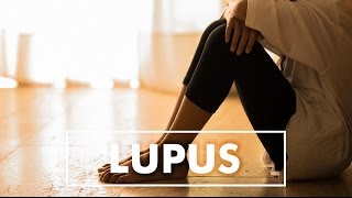 Lupus | Dr. Scott Zashin | Top10MD