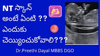 NT Scan I  NT స్కాన్ అంటే ఏంటి ??ఎందుకు చెయ్యించుకోవాలి???  Nuchal transluscency scan