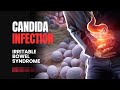 What is Candida Gut Infection? | Explained