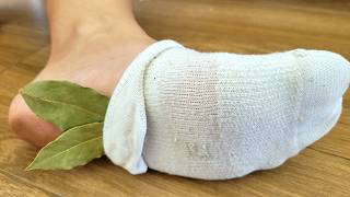 Just PUT BAY LEAF IN YOUR SOCKS! My grandmother FORGOT about the PAIN in her LEGS!