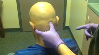 Botox for Migraine by Dr Andrew Blumenfeld