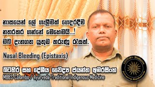 නාසයෙන් ලේ ගැලීමක් ගෙදරදීම නතරකර ගන්නේ මෙහෙමයි | ඔබ දැනගතයුතුම කරුනු රැසක්? | Nasal Bleeding