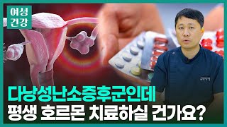 다낭성난소증후군, 피임약을 평생 먹어야 하나요?