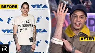 Pete Davidson Has Spent $200K On Tattoo Removals So Far