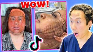 Plastic Surgeon Reacts to INSANE Plastic Surgery TikToks!