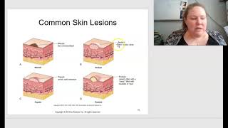 Baker Pathophysiology Chatper 8 Skin Disorders