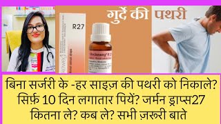 बड़ी से बड़ी पथरी कैसे निकलती है?Kidney Stone Best Homeopathic Medicine?R27 German Drops -Dr Rukmani