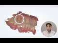 기존 치아와 똑같이 만들기 구강스캐너 사전 프렙이용 ㅣmake the same as existing teeth using oral scanner pre prep