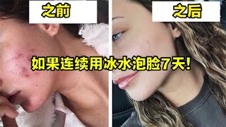 国外百万美妆博主，连续用冰水泡脸7天，镜头记录下皮肤真实变化