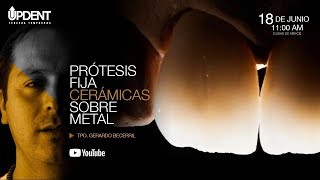 Prótesis Fija, Cerámica sobre metal