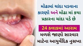 વારંવાર મોઢામાં ચાંદી પડી જાય તો આ વિડીયો એક વખત જરૂર જુઓ.... @mukeshbhai_pharmacist