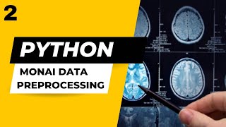 Preprocessing 3D Volumes for Tumor Segmentation using PyTorch and MONAI | Part 2/2