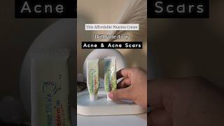 Banish Acne Scars with this✨️ #shorts #acne #acneprone #skincare