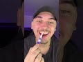 teeth bleaching (TikTok brezaau)