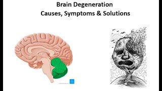 Prevent Brain Degeneration Naturally