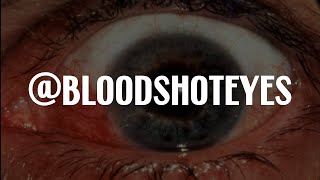 @Bloodshoteyes: A Terrifying Deep Dive | Internet Mysteries