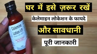 calamine lotion benefits / how to use calamine lotion || uses in hindi