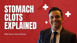 Stomach Blood Clots: Causes, Symptoms & Treatment Explained by a Doctor