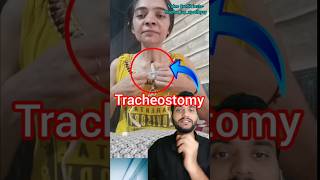 Tracheostomy #shorts