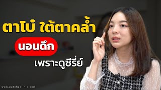 ใต้ตาโบ๋ ใต้ตาลึก ใต้ตาคล้ำ เพราะนอนดึก