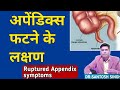 How To Identify Ruptured Appendix Symptoms (Acute Appendicitis) in hindi