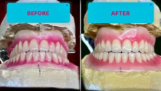 Learn Full Denture Wax-Up Step by Step