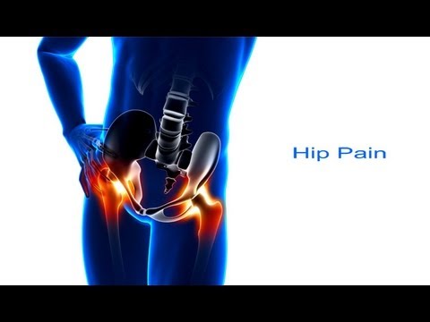 5 Steps to Hip Pain Relief 5 Steps to Hip Pain Relief