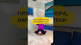 ПЯТОЧНАЯ ШПОРА, ВАРИКОЗ, ОТЕКИ