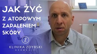 Dermatolog mówi o:  AZS - Jak żyć z atopowym zapaleniem skóry