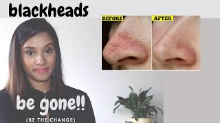 💥IT WORKS!! | Blackhead Removal Method | Anti-Wrinkle | Clear Skin & Tighten Pores |