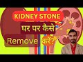 Kidney stone gharpe kese remove kare? By Nt - Amit kumar