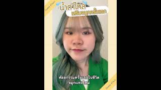 เสริมจมูกครั้งแรก น้ำตาไหลเป็นสายเพราะ....I  รีวิวลูกสาวหมอ Sowon clinic ep.271