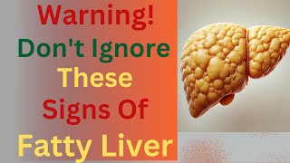 9 Silent Signs And Symptoms Of Fatty Liver Disease (And How To Fix It Fast!)\