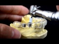 Dental implant surgical guide drilling protocol