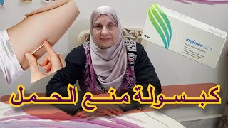 كبسولة منع الحمل تحت الجلد