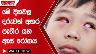 මේ දිනවල දරුවන් අතර පැතිර යන ඇස් රෝගය - Aruna.lk - Derana Aruna