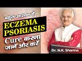 Most Easiest Way To Cure Eczema & Psoriasis || Cure Skin Problems Naturally || Dr. NK Sharma