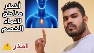 تعرف على اخطر نقاط الضعف لاغماء الخصم بضربة واحدة في قتال الشارع - The weak spots of the human body