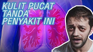 Kulit Pucat Pertanda Apa?