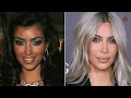 konaČno priznala kim kardašijan stavlja botox u vrat