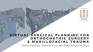Virtual Surgical Planning for Orthognathic Surgery & Maxillofacial Trauma