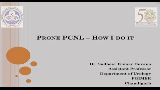 Prone PCNL   How I do it