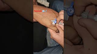 #cannula #doctor #mbbs #nursing #doctorlife #viralvideo #shortvideo