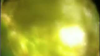 Foldscope stomata | Puthina leaf stomata | Environcare