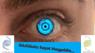 Alcon marka Akıllı lens, mercek akıllımı ? Ameliyattan 1 ay sonrası Haziran 2024